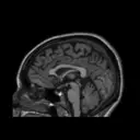 Logo of Yale Brain Imaging Program